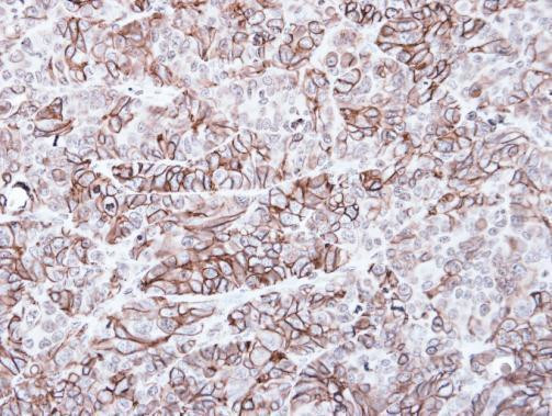 FZD8 Antibody in Immunohistochemistry (Paraffin) (IHC (P))