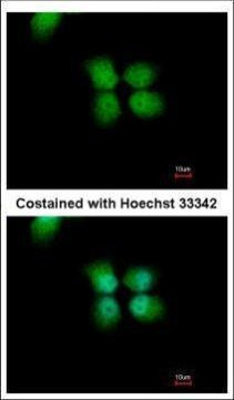 ORC4 Antibody in Immunocytochemistry (ICC/IF)