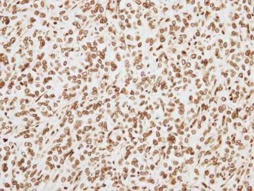 ORC6 Antibody in Immunohistochemistry (Paraffin) (IHC (P))