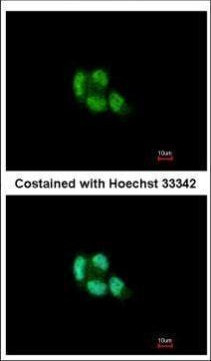 PSMB5 Antibody in Immunocytochemistry (ICC/IF)