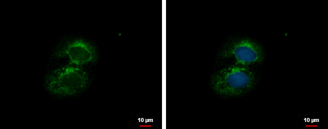 TBPL1 Antibody in Immunocytochemistry (ICC/IF)