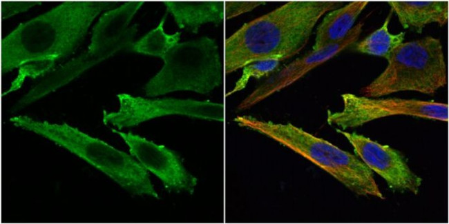Stathmin 1 Antibody in Immunocytochemistry (ICC/IF)