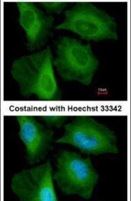 CacyBP Antibody in Immunocytochemistry (ICC/IF)