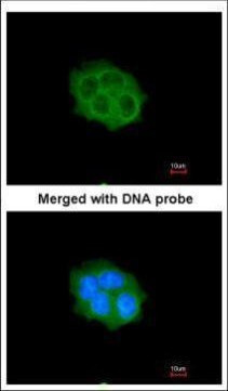 SPHK1 Antibody in Immunocytochemistry (ICC/IF)