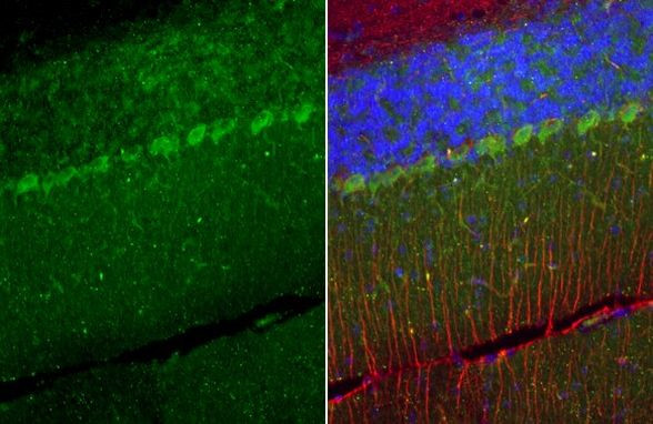 TRPC6 Antibody in Immunohistochemistry (Paraffin) (IHC (P))