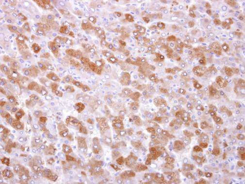 TRPM7 Antibody in Immunohistochemistry (Paraffin) (IHC (P))