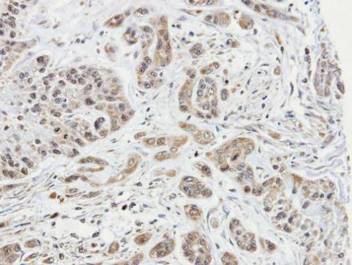 ARPC1A Antibody in Immunohistochemistry (Paraffin) (IHC (P))