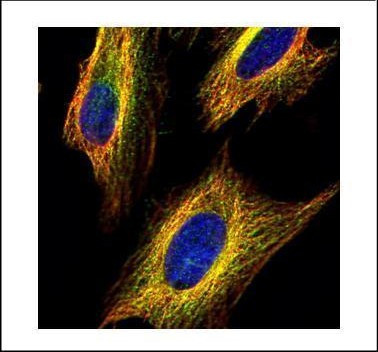 VDAC2 Antibody in Immunocytochemistry (ICC/IF)