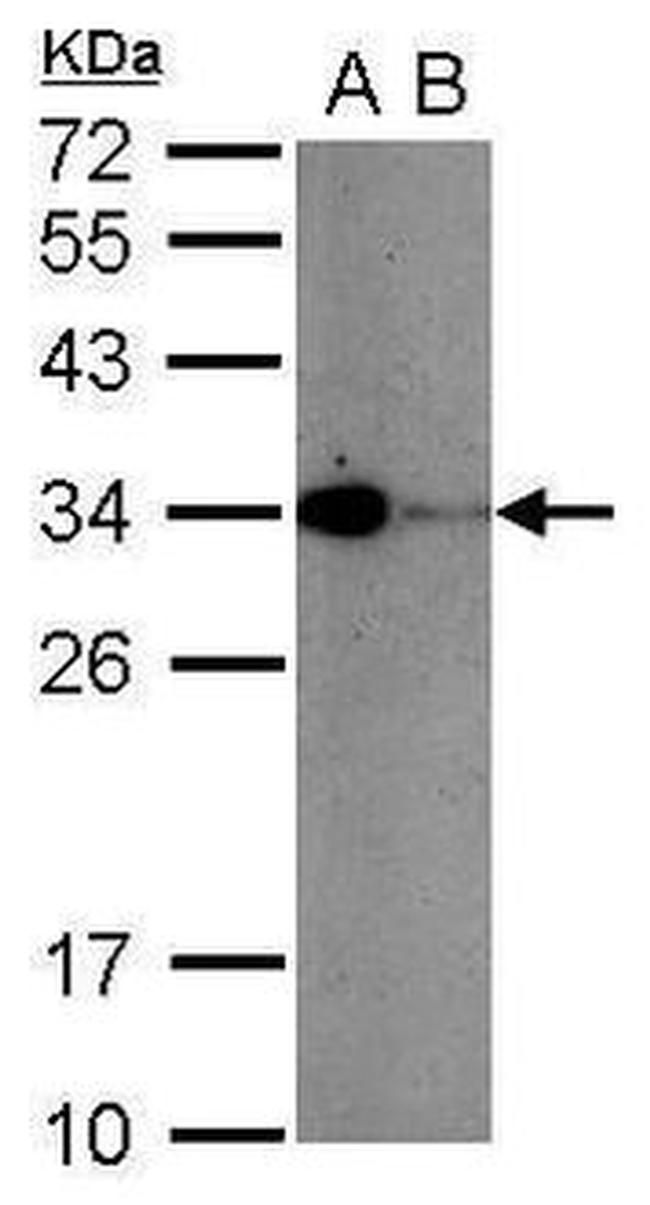 CD279 (PD-1) Antibody in Western Blot (WB)
