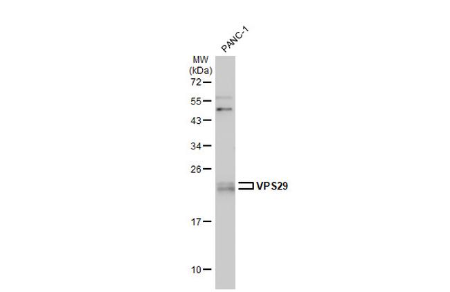VPS29 Antibody in Western Blot (WB)