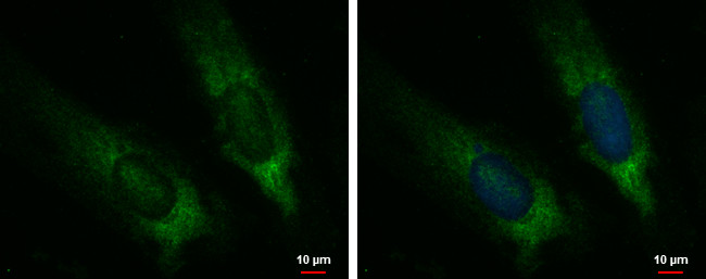 CYP7B1 Antibody in Immunocytochemistry (ICC/IF)