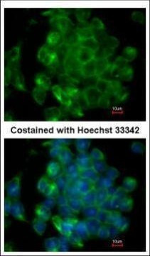 SIPA1 Antibody in Immunocytochemistry (ICC/IF)