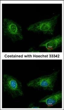 Asporin Antibody in Immunocytochemistry (ICC/IF)