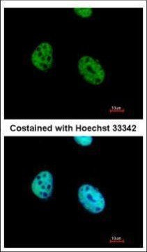 ATF7 Antibody in Immunocytochemistry (ICC/IF)