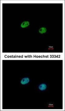 IRF5 Antibody in Immunocytochemistry (ICC/IF)