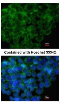 IRF6 Antibody in Immunocytochemistry (ICC/IF)