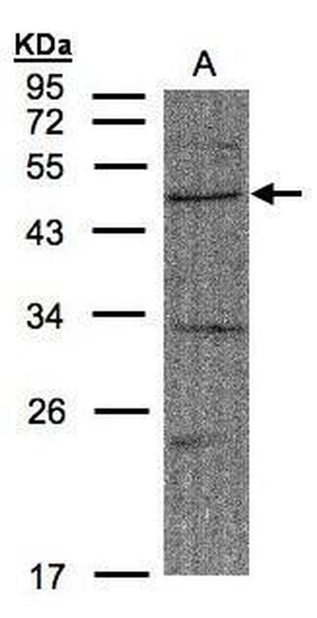 FBXW2 Antibody in Western Blot (WB)
