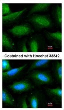 FBXL2 Antibody in Immunocytochemistry (ICC/IF)