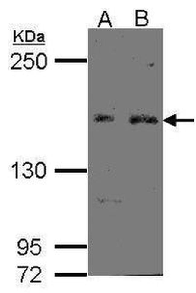 FBXL10 Antibody in Western Blot (WB)
