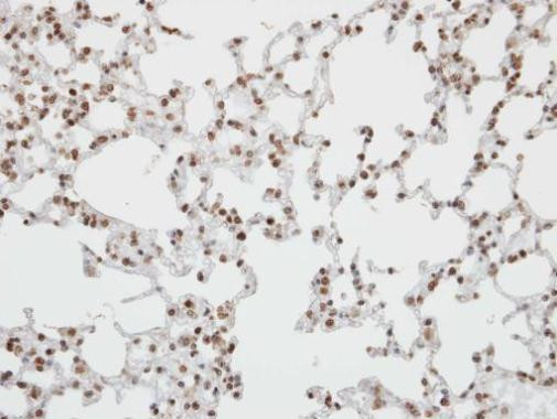 Pokemon Antibody in Immunohistochemistry (Paraffin) (IHC (P))