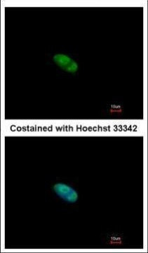 ZNF148 Antibody in Immunocytochemistry (ICC/IF)