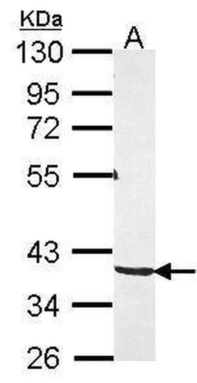 PKA gamma Antibody in Western Blot (WB)