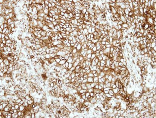 HLA-DRB1 Antibody in Immunohistochemistry (Paraffin) (IHC (P))
