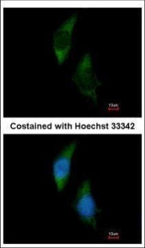 FARSA Antibody in Immunocytochemistry (ICC/IF)