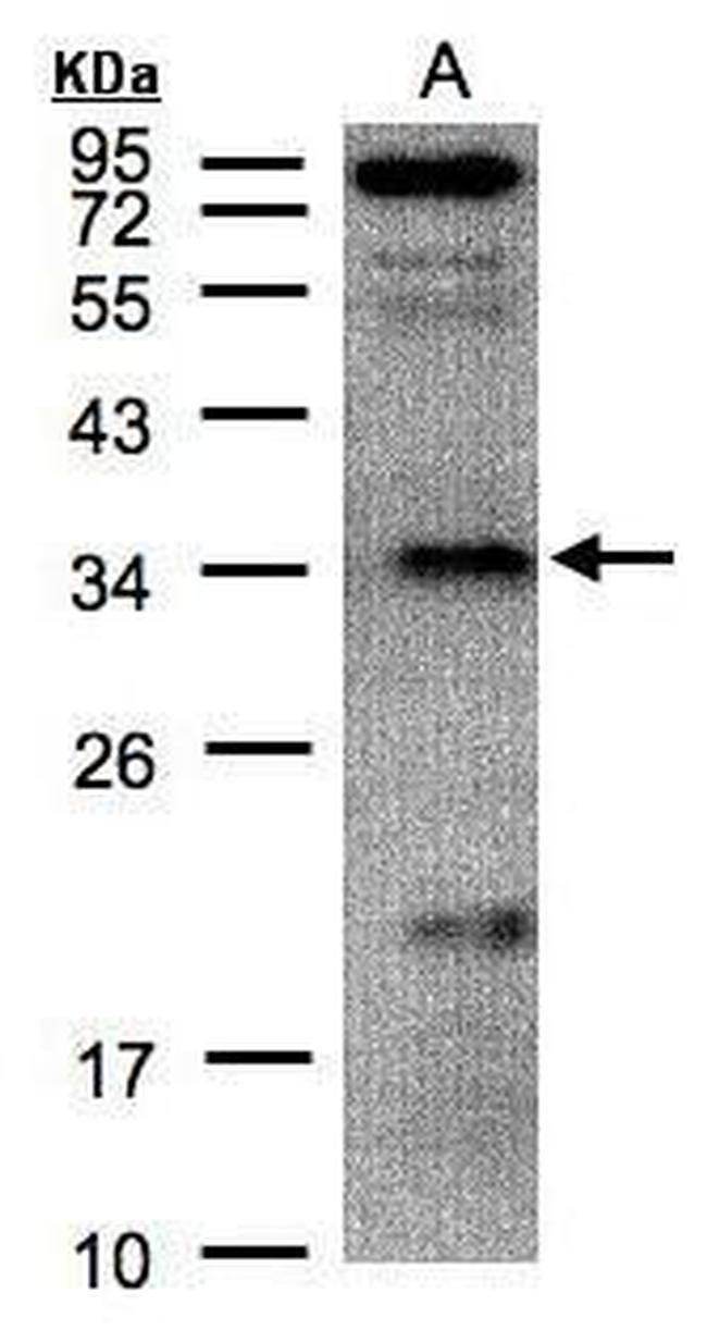 FN3KRP Antibody in Western Blot (WB)