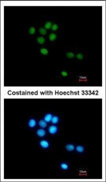 TULP3 Antibody in Immunocytochemistry (ICC/IF)