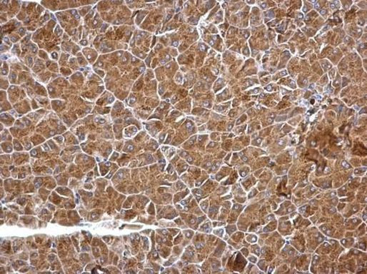 FGFR4 Antibody in Immunohistochemistry (Paraffin) (IHC (P))