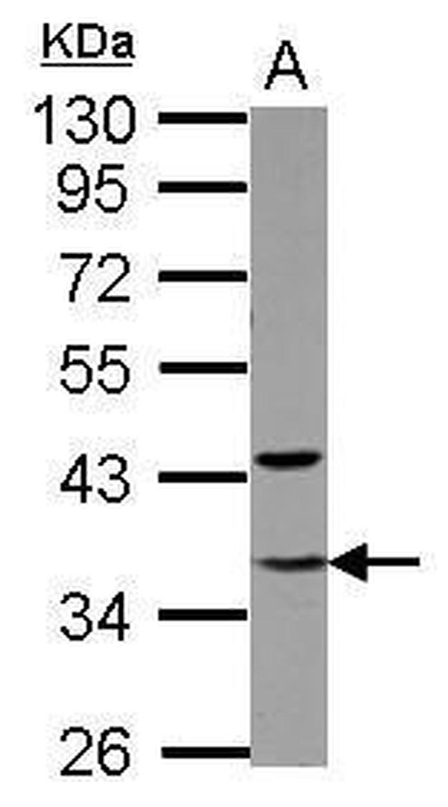GTF2E2 Antibody in Western Blot (WB)