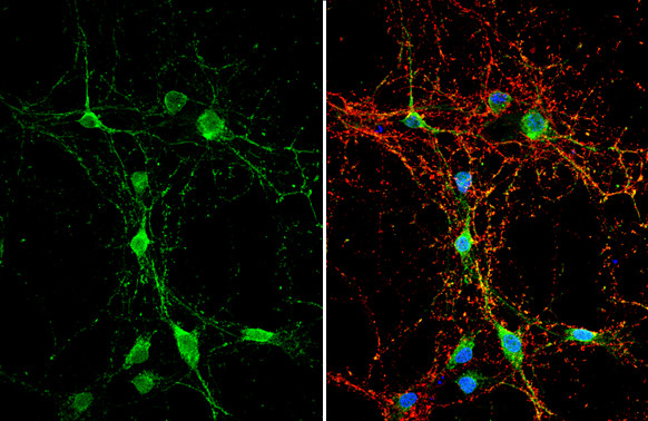 alpha Dystroglycan Antibody in Immunocytochemistry (ICC/IF)
