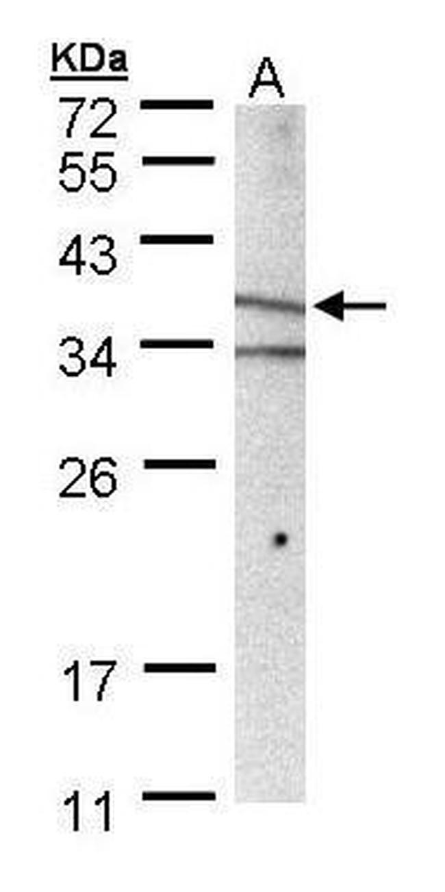 MICA Antibody in Western Blot (WB)