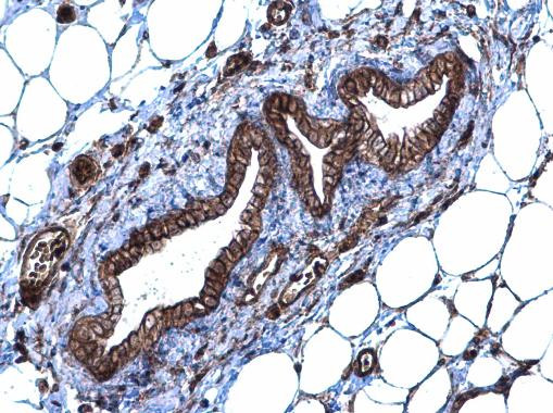 SLC20A1 Antibody in Immunohistochemistry (Paraffin) (IHC (P))