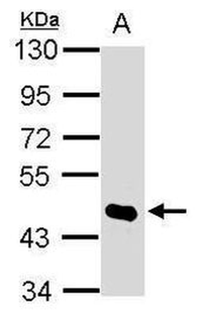 HDAC8 Antibody in Western Blot (WB)