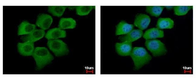 SEMA6A Antibody in Immunocytochemistry (ICC/IF)