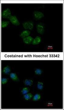 HSP701L Antibody in Immunocytochemistry (ICC/IF)