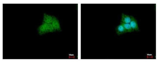 CDK20 Antibody in Immunocytochemistry (ICC/IF)