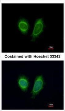 DDX1 Antibody in Immunocytochemistry (ICC/IF)
