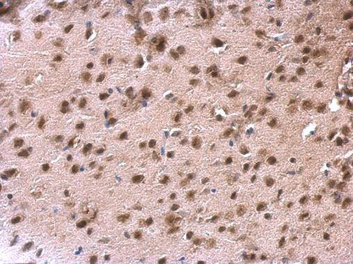 DDX1 Antibody in Immunohistochemistry (Paraffin) (IHC (P))