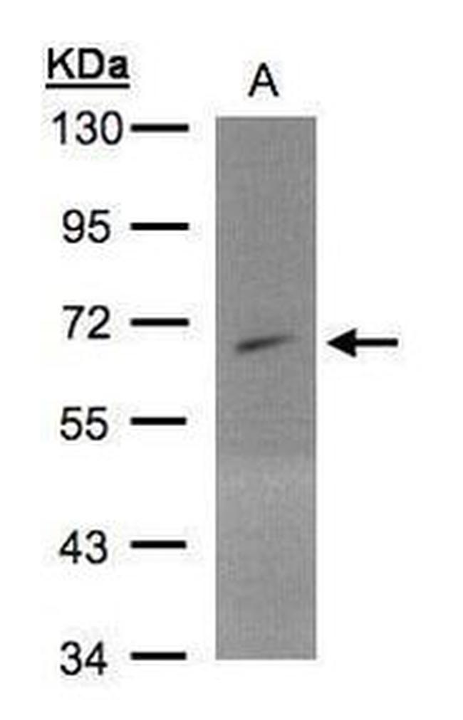 PIP5K1A Antibody in Western Blot (WB)