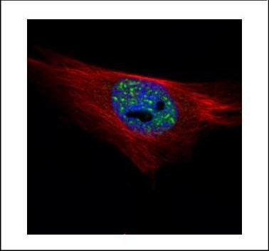 PP1 alpha Antibody in Immunocytochemistry (ICC/IF)