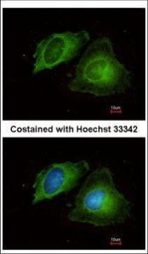 MMP17 Antibody in Immunocytochemistry (ICC/IF)