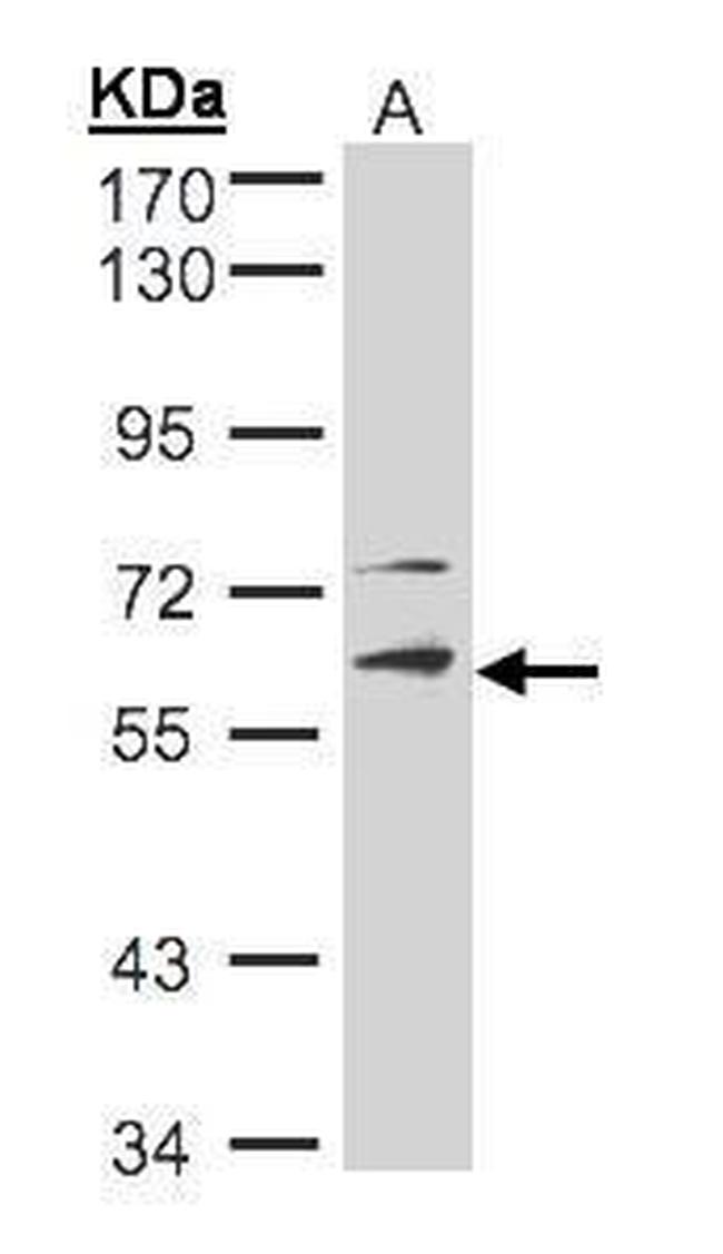 STK33 Antibody in Western Blot (WB)