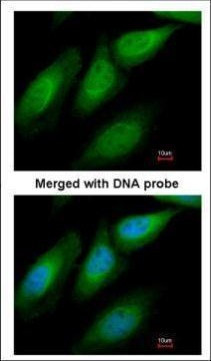 SUGT1 Antibody in Immunocytochemistry (ICC/IF)