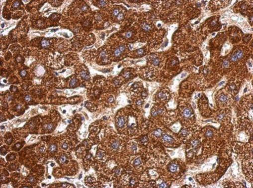 LSS Antibody in Immunohistochemistry (Paraffin) (IHC (P))