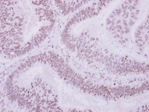 ULK4 Antibody in Immunohistochemistry (Paraffin) (IHC (P))