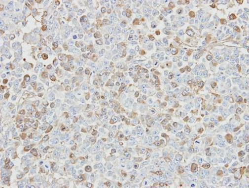 USP5 Antibody in Immunohistochemistry (Paraffin) (IHC (P))