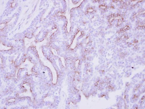 CDO Antibody in Immunohistochemistry (Paraffin) (IHC (P))